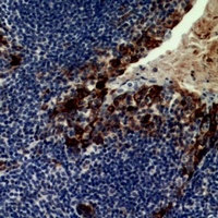 CD21 Antibody