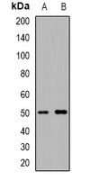CD127 Antibody