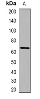 IL-31 Antibody