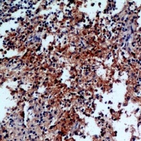 IL-31 Antibody
