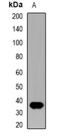 IL-12B Antibody