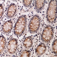 IL-12B Antibody