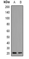 PTHRP Rabbit Polyclonal Antibody