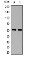 Perforin 1 Rabbit Polyclonal Antibody