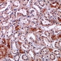Perforin 1 Rabbit Polyclonal Antibody