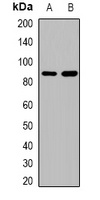Beta Amyloid Antibody
