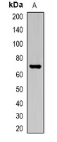ALB Antibody