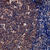 Tryptase delta Rabbit Polyclonal Antibody