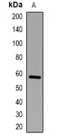 FBXO7 Rabbit Polyclonal Antibody