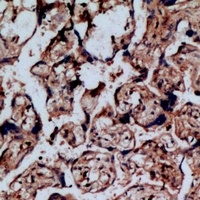 NOP56 Rabbit Polyclonal Antibody