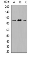 VPS35 Rabbit Polyclonal Antibody
