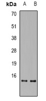 RPA3 Rabbit Polyclonal Antibody