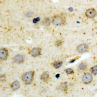 BID (Phospho-S78) Antibody