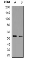 p53 (TriMethyl-K370) Rabbit Polyclonal Antibody