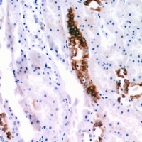 PTHR1 Rabbit Polyclonal Antibody