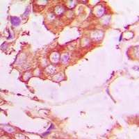 EPN2 Rabbit Polyclonal Antibody
