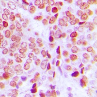PE2 (Phospho-T526) Antibody