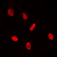 PE2 (Phospho-T526) Antibody