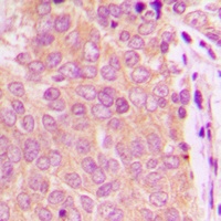 Separase Rabbit Polyclonal Antibody