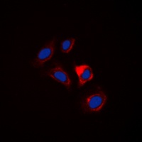 Separase Rabbit Polyclonal Antibody