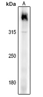 Filaggrin Rabbit Polyclonal Antibody