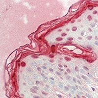 Filaggrin Rabbit Polyclonal Antibody