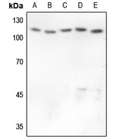 GAB1 Rabbit Polyclonal Antibody