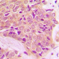 GAB1 Rabbit Polyclonal Antibody