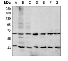 GAS6 Rabbit Polyclonal Antibody