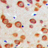 GAS6 Rabbit Polyclonal Antibody