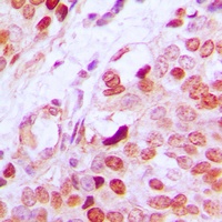 GATA1 (Phospho-S142) Antibody