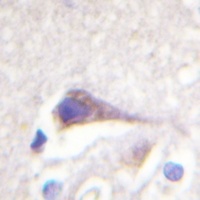 GFAP Antibody