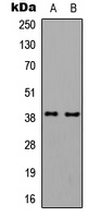 GNAL Rabbit Polyclonal Antibody
