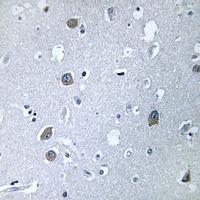 GNAL Rabbit Polyclonal Antibody
