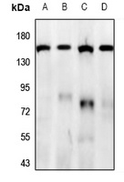 GPR158 Rabbit Polyclonal Antibody
