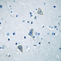 GPR158 Rabbit Polyclonal Antibody