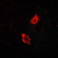 GPR158 Rabbit Polyclonal Antibody