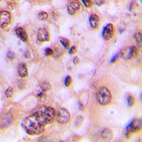 GSK3 beta (Phospho-S9) Antibody