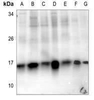Histone H2B (Acetyl-K5) Rabbit Polyclonal Antibody