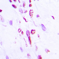Histone H2B (Acetyl-K5) Rabbit Polyclonal Antibody