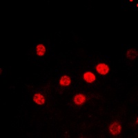 Histone H2B (Acetyl-K5) Rabbit Polyclonal Antibody