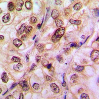 Histone Deacetylase 5/9 (Phospho-S259/220) Antibody