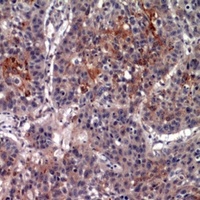 CD213a2 Rabbit Polyclonal Antibody