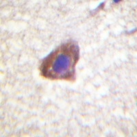 CD130 Antibody