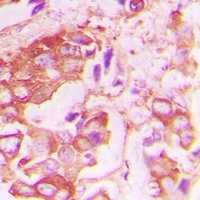 Insulin Receptor (Phospho-Y1355) Antibody