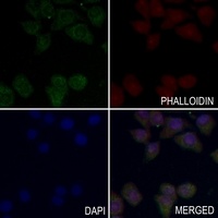Insulin Receptor (Phospho-Y1355) Antibody