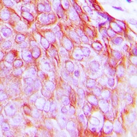 Insulin Receptor (Phospho-Y1361) Antibody