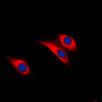 Insulin Receptor (Phospho-Y1361) Antibody