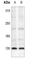 IRS1 (Phospho-S307) Antibody