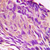 IRS1 (Phospho-S307) Antibody